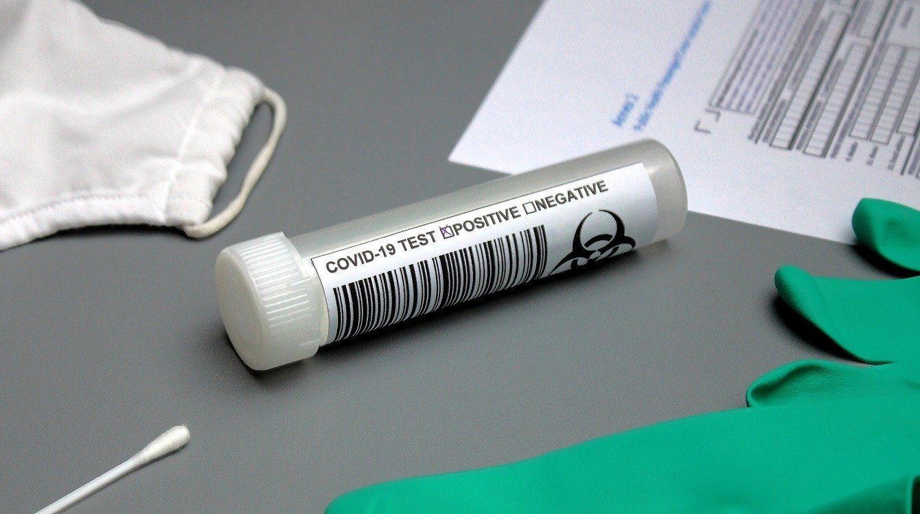Nákup antigenních testů do škol